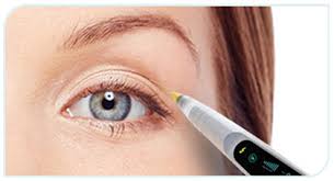 blepharoplastie-laser-tunisie